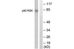 Western blot analysis of extracts from 293 cells, treated with PMA 125ng/ml 30', using p90 RSK (Ab-359/363) Antibody. (RPS6KA3 Antikörper  (AA 331-380))