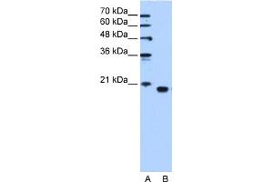 WB Suggested Anti-PEBP1 Antibody Titration:  1. (PEBP1 Antikörper  (C-Term))