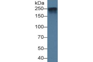 Western Blotting (WB) image for Pappalysin 2 (PAPPA2) ELISA Kit (ABIN6574318)