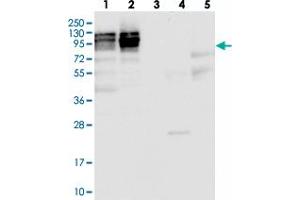 Western blot analysis of Lane 1: RT-4, Lane 2: U-251 MG, Lane 3: Human Plasma, Lane 4: Liver, Lane 5: Tonsil with NOP2 polyclonal antibody  at 1:100-1:250 dilution.