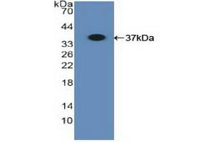 Detection of Recombinant MHCB, Human using Polyclonal Antibody to Major Histocompatibility Complex Class I B (MHCB)