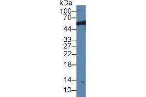 Western blot analysis of Rat Serum, using Rat NUP50 Antibody (1 µg/ml) and HRP-conjugated Goat Anti-Rabbit antibody ( (NUP50 Antikörper  (AA 179-428))