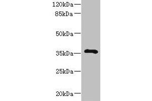 Western blot All lanes: GIMAP7 antibody at 2 μg/mL + Jurkat whole cell lysate Secondary Goat polyclonal to rabbit IgG at 1/10000 dilution Predicted band size: 35 kDa Observed band size: 35 kDa