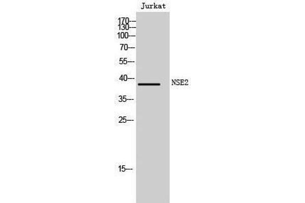 NSMCE2 Antikörper  (N-Term)