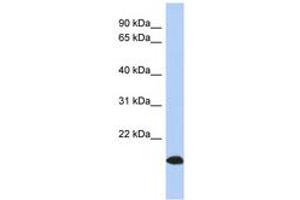 Image no. 1 for anti-ADP-Ribosylation Factor-Like 17A (ARL17A) (AA 107-156) antibody (ABIN6744026) (ARL17A Antikörper  (AA 107-156))