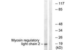Western blot analysis of extracts from COLO205 cells, using MRLC2 (Ab-18) Antibody. (MYL12B Antikörper  (AA 3-52))