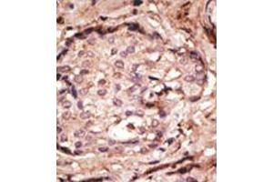 Image no. 2 for anti-Glial Fibrillary Acidic Protein (GFAP) (N-Term) antibody (ABIN357395) (GFAP Antikörper  (N-Term))