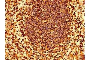 Immunohistochemistry (IHC) image for anti-Major Histocompatibility Complex Class I C (HLA-C) (AA 62-306) antibody (ABIN7155571)