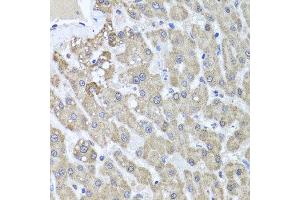 Immunohistochemistry of paraffin-embedded human liver injury using ALKBH4 antibody at dilution of 1:100 (x40 lens).
