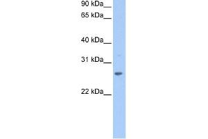 WB Suggested Anti-CRISP1 Antibody Titration: 0. (CRISP1 Antikörper  (N-Term))