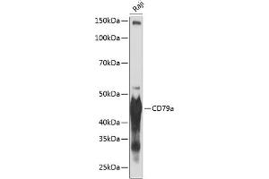 Western blot analysis of extracts of Raji cells, using CD79a antibody (ABIN7265805) at 1:1000 dilution. (CD79a Antikörper)