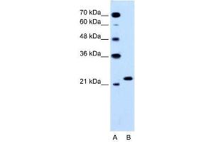 RAB14 antibody (70R-10565) used at 1. (RAB14 Antikörper  (C-Term))