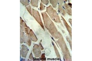 Immunohistochemistry (IHC) image for anti-Creatine Kinase, Muscle (CKM) antibody (ABIN3002974) (CKM Antikörper)