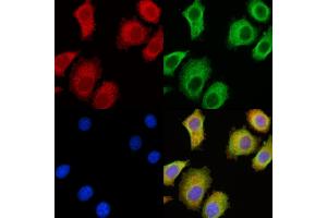 ABIN6264976 and ABIN6278525 staining HepG2 cells by IF/ICC.