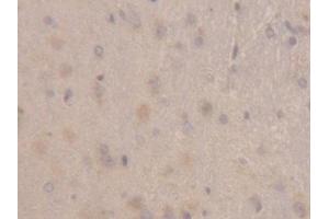 Detection of RBP1 in Rat Cerebrum Tissue using Polyclonal Antibody to Retinol Binding Protein 1, Cellular (RBP1) (RBP1 Antikörper  (AA 2-135))