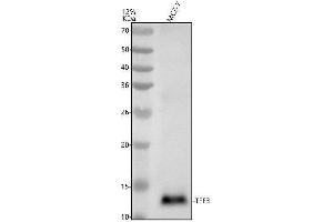 Western blot analysis of Trefoil factor 3/TFF3 using anti-Trefoil factor 3/TFF3 antibody (ABIN7606571).