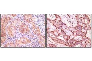 Immunohistochemistry (IHC) image for anti-Synuclein, gamma (Breast Cancer-Specific Protein 1) (SNCG) antibody (ABIN1845097) (SNCG Antikörper)