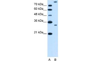 WB Suggested Anti-GZMK Antibody Titration:  0. (GZMK Antikörper  (N-Term))
