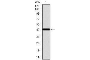 Western Blotting (WB) image for anti-Keratin 13 (KRT13) (AA 143-295) antibody (ABIN969578)