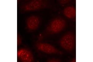 Immunofluorescence analysis of methanol-fixed MCF-7 cells using Phospho-PRKCB-T641 antibody (ABIN3019760, ABIN3019761, ABIN3019762, ABIN1681948 and ABIN1681949). (PRKCA/PRKCB (pThr638), (pThr641) Antikörper)