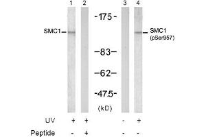 Image no. 2 for anti-Structural Maintenance of Chromosomes 1A (SMC1A) (pSer957) antibody (ABIN196936) (SMC1A Antikörper  (pSer957))
