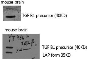 Western Blotting (WB) image for anti-Transforming Growth Factor, beta 1 (TGFB1) (C-Term) antibody (ABIN3187249) (TGFB1 Antikörper  (C-Term))