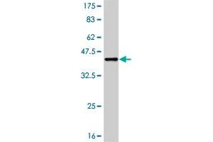 Western Blot detection against Immunogen (37. (RIPK2 Antikörper  (AA 431-540))