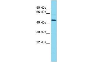 Host: Rabbit Target Name: MLIP Sample Type: MCF7 Whole Cell lysates Antibody Dilution: 1. (MLIP Antikörper  (Middle Region))