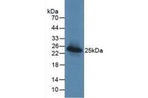 Western Blot; Sample: Recombinant LGALS3BP, Human. (LGALS3BP Antikörper  (AA 24-221))