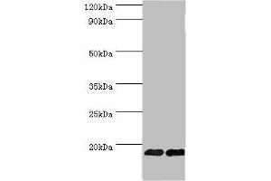 Western blot All lanes: Fibroblast growth factor 1 antibody at 6 μg/mL Lane 1: Mouse kidney tissue Lane 2: Mouse heart tissue Secondary Goat polyclonal to rabbit IgG at 1/10000 dilution Predicted band size: 18, 7 kDa Observed band size: 18 kDa (FGF1 Antikörper  (AA 16-155))