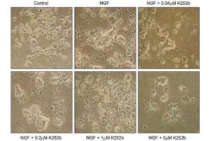 Cells were incubated in the presence or absence of 10 ng/mL NGF with or without various concentrations of K252b (ABIN7885841). (K252b)