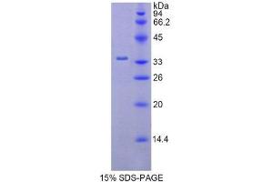 SDS-PAGE (SDS) image for Hexokinase 2 (HK2) (AA 619-917) protein (His tag) (ABIN1878418) (Hexokinase 2 Protein (HK2) (AA 619-917) (His tag))