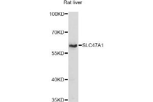 Western blot analysis of extracts of rat liver, using SLC47A1 antibody (ABIN6292279) at 1:1000 dilution. (SLC47A1 Antikörper)