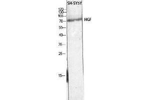 Western Blot (WB) analysis of SH-SY5Y lysis using HGF antibody. (HGF Antikörper)
