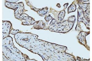 IHC analysis of RAE1 using anti-RAE1 antibody (ABIN7602428). (RAE1 Antikörper  (AA 76-368))
