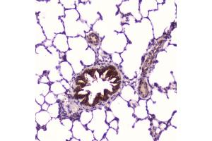 Immunohistochemistry (IHC) image for anti-Insulin-Like Growth Factor Binding Protein 2, 36kDa (IGFBP2) (AA 35-304) antibody (ABIN6654166)