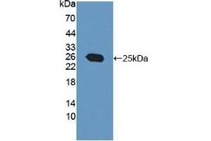 Detection of Recombinant PTP4A3, Human using Polyclonal Antibody to Protein Tyrosine Phosphatase Type IVA 3 (PTP4A3) (PTP4A3 Antikörper  (AA 1-170))