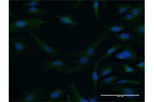 Immunofluorescence of purified MaxPab antibody to DTNA on HeLa cell. (DTNA Antikörper  (AA 1-371))