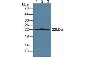 Western blot analysis of (1) Mouse Brain Tissue, (2) Mouse Heart Tissue and (3) Porcine Brain Tissue. (CRYAB Antikörper  (AA 1-175))