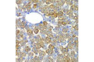 Immunohistochemistry of paraffin-embedded mouse liver using FAH antibody.