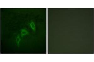 Immunofluorescence analysis of HepG2 cells, using Tuberin/TSC2 (Ab-939) Antibody. (Tuberin Antikörper  (AA 905-954))