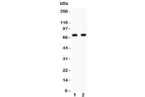 Western blot testing of Numb antibody and Lane 1: human U87 (NUMB Antikörper  (AA 194-220))