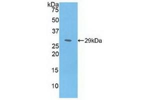 Detection of Recombinant MAT2a, Human using Polyclonal Antibody to Methionine Adenosyltransferase II Alpha (MAT2a)