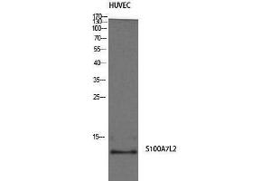 Western Blotting (WB) image for anti-S100 Calcium Binding Protein A7-Like 2 (S100A7L2) (Internal Region) antibody (ABIN3186865) (S100A7L2 Antikörper  (Internal Region))