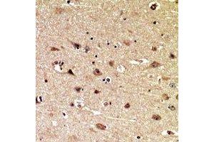 Immunohistochemical analysis of MIB1 staining in human brain formalin fixed paraffin embedded tissue section. (MIB1 Antikörper  (C-Term))