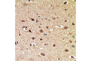 Immunohistochemical analysis of MIB1 staining in human brain formalin fixed paraffin embedded tissue section.
