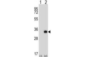Western Blotting (WB) image for anti-Testis-Specific Serine Kinase 6 (TSSK6) antibody (ABIN2997885) (TSSK6 Antikörper)