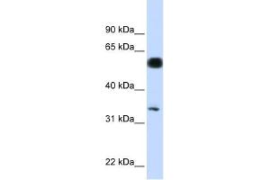 C19ORF62 antibody used at 1 ug/ml to detect target protein. (BRISC and BRCA1 A Complex Member 1 (BABAM1) (N-Term) Antikörper)