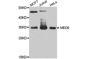 Western blot analysis of extracts of various cell lines, using MED6 antibody. (MED6 Antikörper  (AA 27-246))