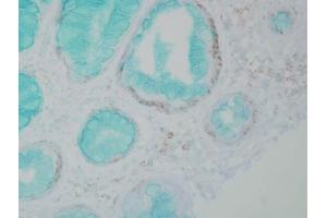 Immunohistochemistry analysis using Mouse Anti-DNMT1 Monoclonal Antibody, Clone 60B1220. (DNMT1 Antikörper  (AA 637-650) (Biotin))